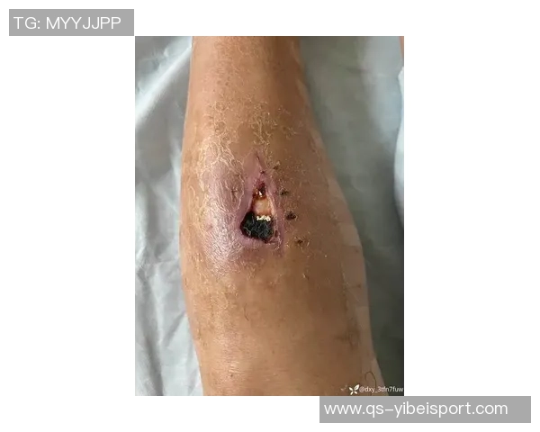 浓眉再遇伤病困扰首节小腿受伤退赛仅得4分4板表现受限